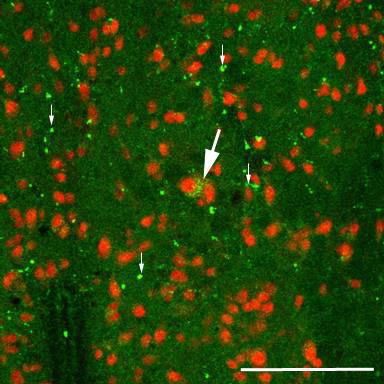 Patkány CM, kettıs immunjelölés. Neuronok sejtmagját NeuN immunreakcióval jelöltük (piros).