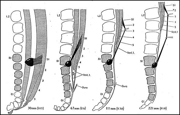 velıcsıvel együtt fejlıdı dúclécbıl származnak a gerincvelıi ganglionok. A FT viszont már a farokbimbóból származik (Nievelstein és mtsai., 1993) 1. ábra.