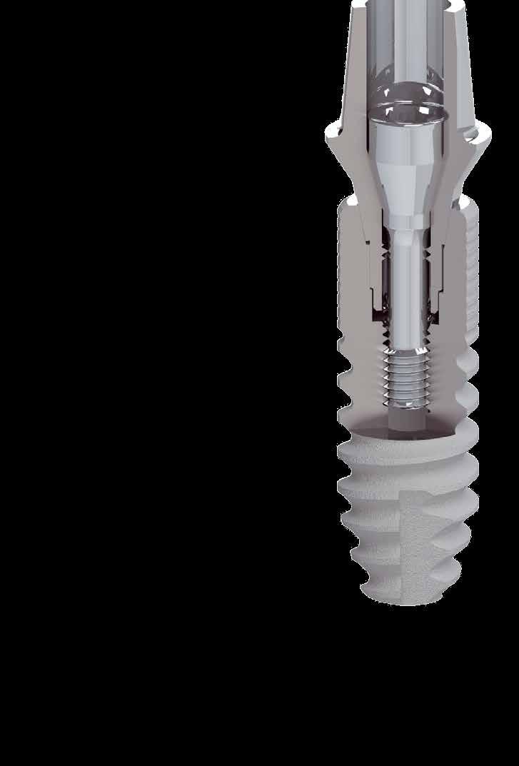 The fair implant system Az átmenő csavar a felépítményben található önzáró