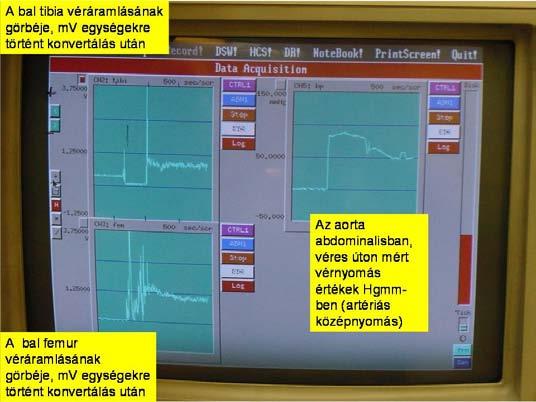 5. ábra Mérési kép a háromcsatornás monitoron A vázlatos kísérleti elrendezést a 6.