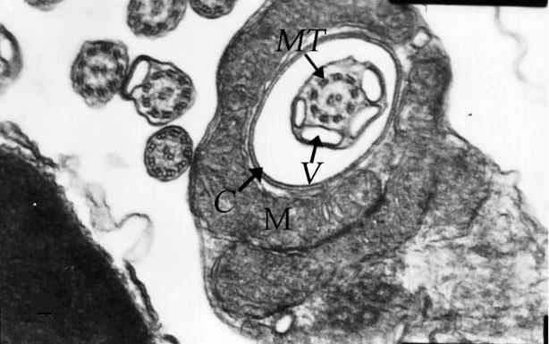 A spermium ostora, vagy flagelluma biztosítja a sejt mozgási képességét, melynek hossza 3-6 µm lehet (ISLAM és AKHTER 211).