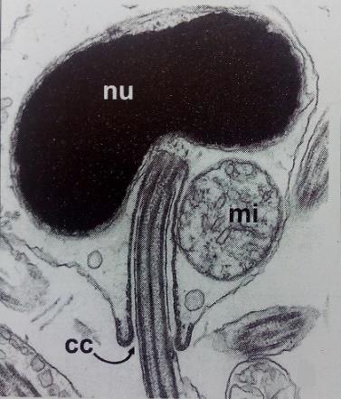 az angolnaalakúak (Anguilliformes) és a gyíkfejűhal-alakúak (Elopiformes) esetében a centrális mikortubulusok nélküli, 9+-s struktúra alakult ki.