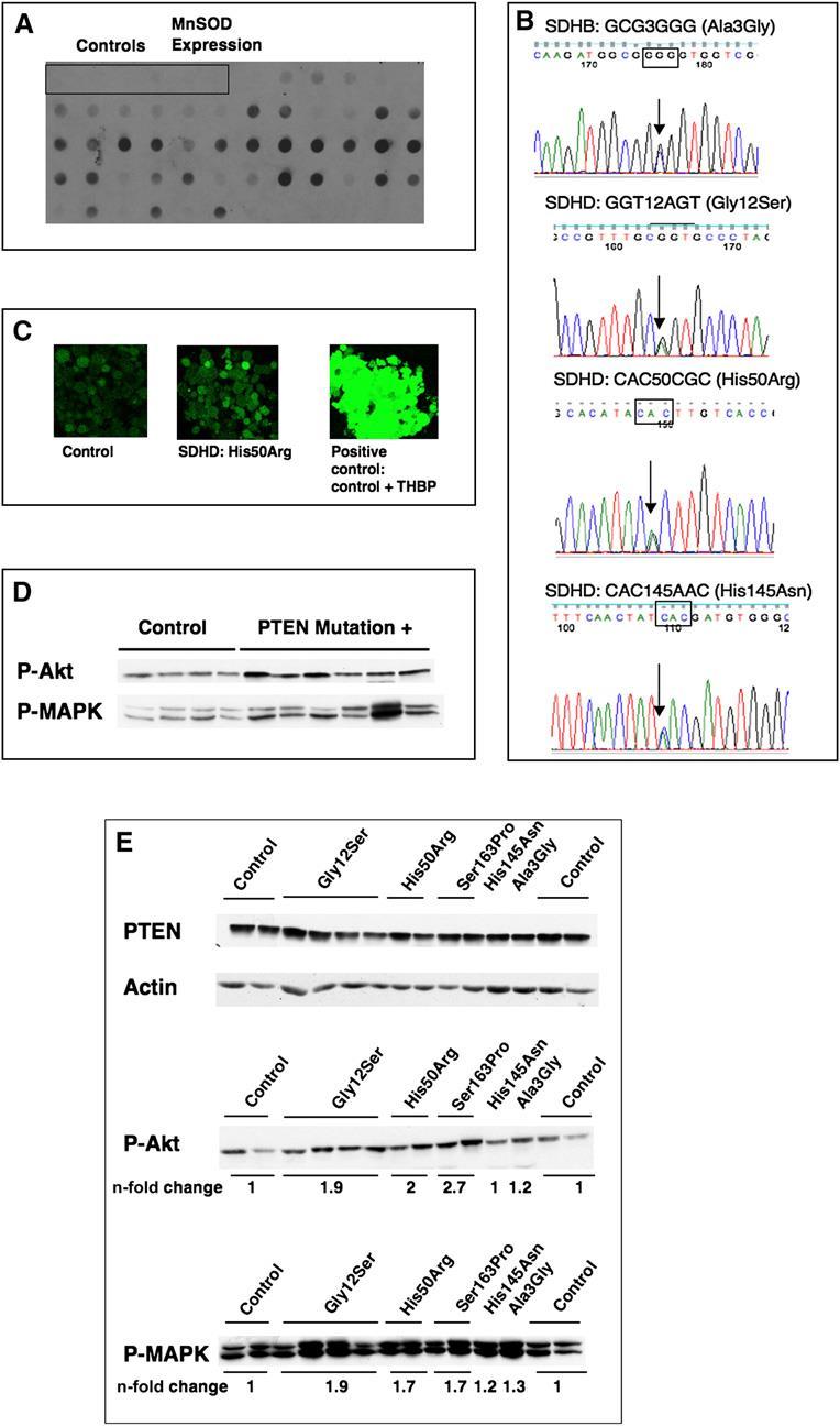 22. Ábra: A PTEN-mutáció negatív CS és CS-szerű szindrómában szenvedő betegek genetikai és biokémiai tulajdonságai. A panel: a MnSOD expressziója dot blot technikával.