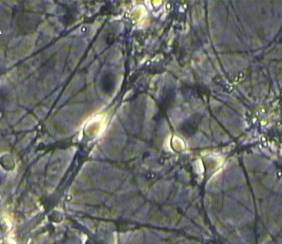 Glia-neuron interakció Szinaptogenezis Néhány hetes tiszta RGC (retinal ganglion cell) vagy gerincvelői
