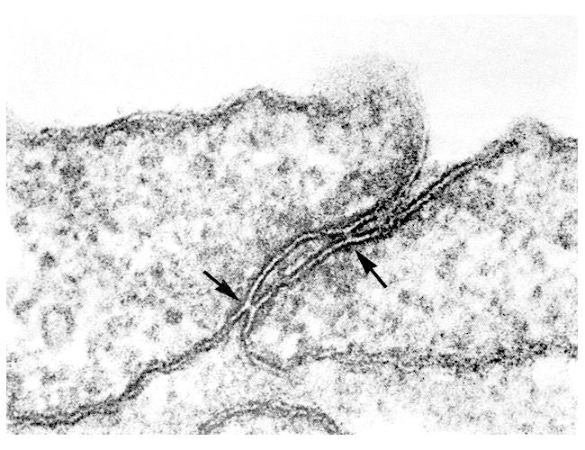 endothelial cell (EC) tight junctions (arrows) part of a pericyte (P)