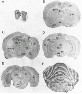 IL-1 receptorok eloszlása patkány agyban 125 I-jelzett