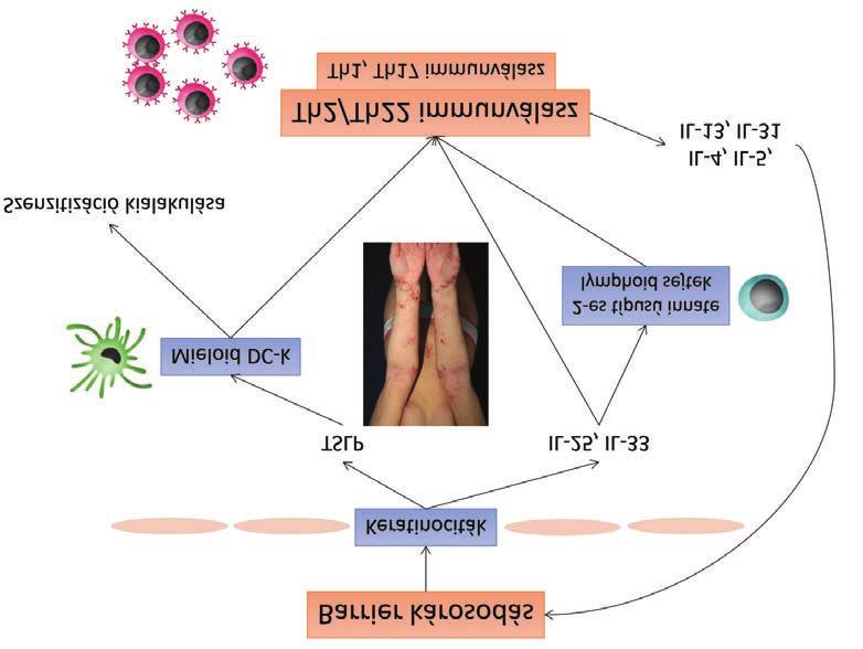 2. ábra Az AD patomechanizmusa. Két hipotézis ismert az AD kialakulására. Az inside-out hipotézis kiinduló pontnak a Th2 aktivációt tartja, mely károsítja a bőr fizikokémiai barriert.