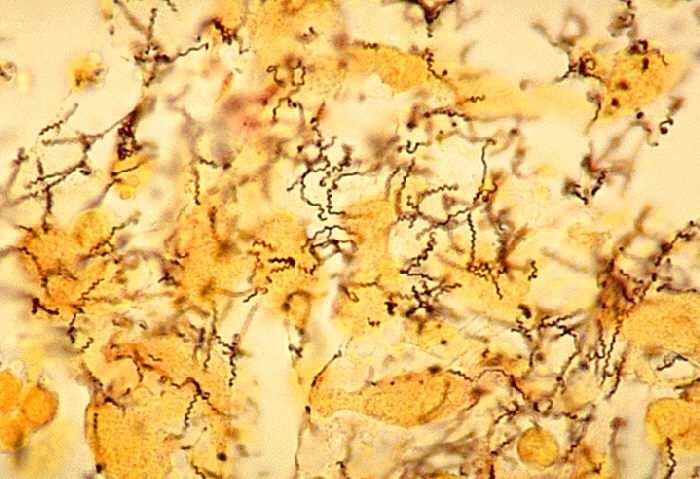 Haemophilus