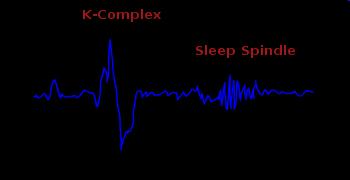 A K-komplex paradoxonja K komplex: éber vagy alvó jegy? Éber: hangingerrel kiváltható. Szívritmus fokozódás kíséri az elején. Alvás felszínesebb stádiumaiban jelenik meg.