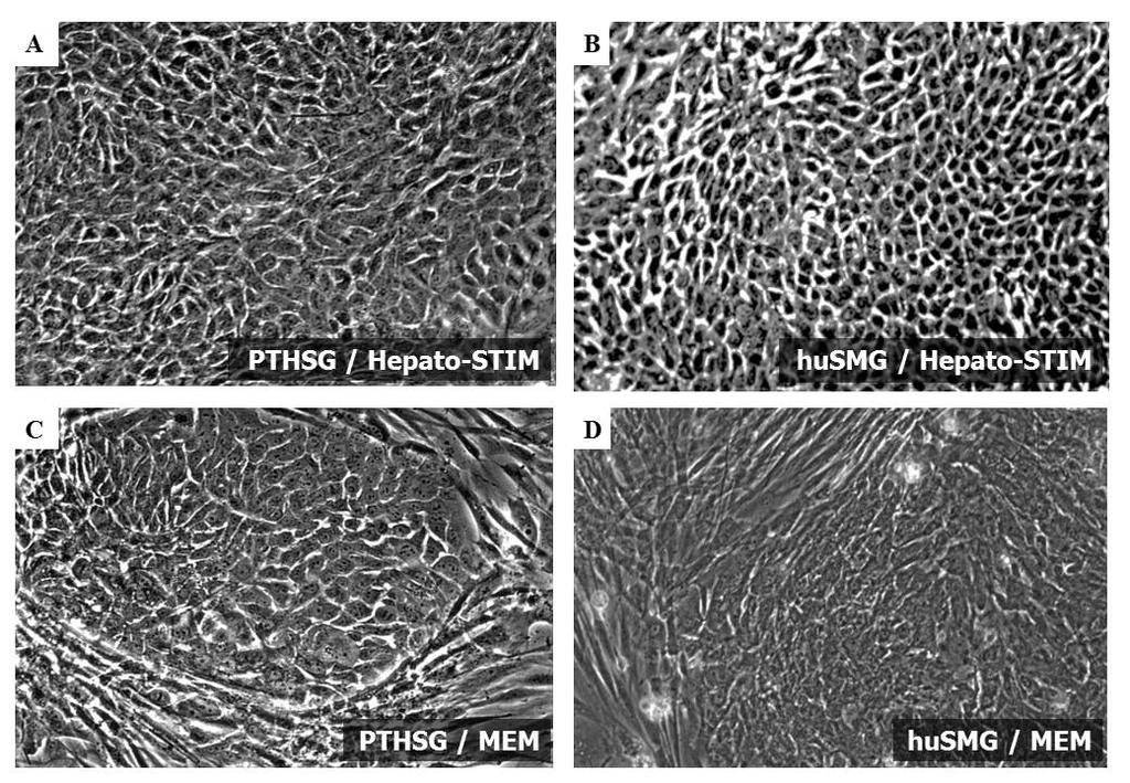 8. ábra A sejttenyésztő tápoldat szerepe az epiteliális differenciációban Fáziskontraszt mikroszkópos képek a PTHSG és a husmg