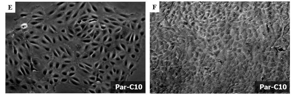 Kontrollként a Par- C10 sejtek láthatók: a fáziskontraszt kép a plasztik aljzaton kialakuló epiteliális szigeteket (E), az
