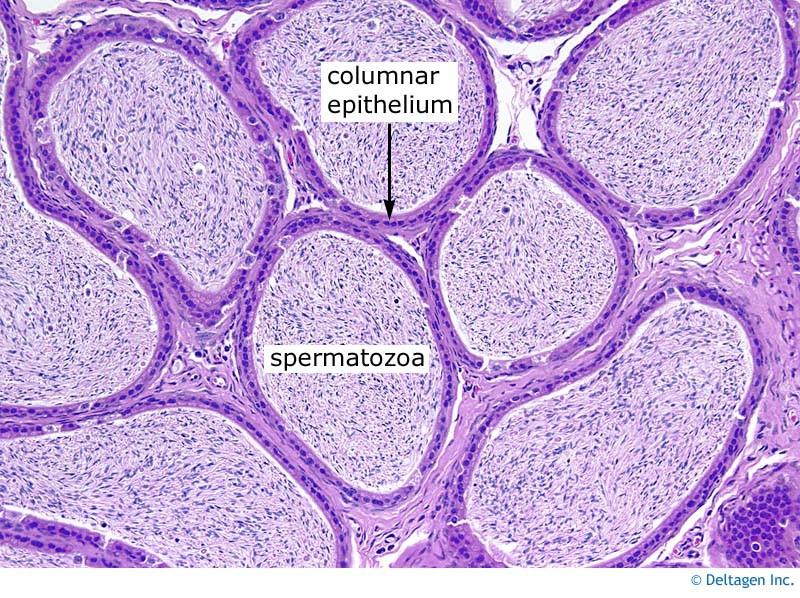 tubules