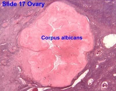 Corpus albicans: