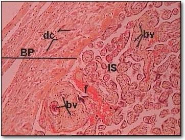 BP = basal plate