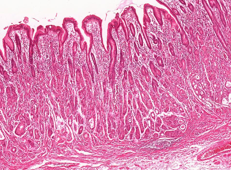 foveolae gastricae plica villosa Cardia