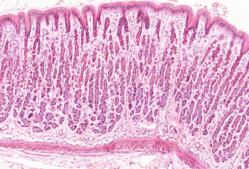 Fundus-corpus (2) foveolae gastricae