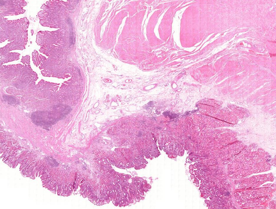 pylorus Pylorus-duodenum átmenet (1) m.