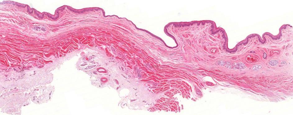 Oesophagus > tunica mucosa (nyálkahártya) > tela submucosa / tunica submucosa > tunica muscularis >