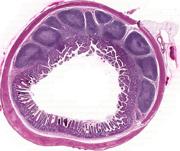 Ileum (1)