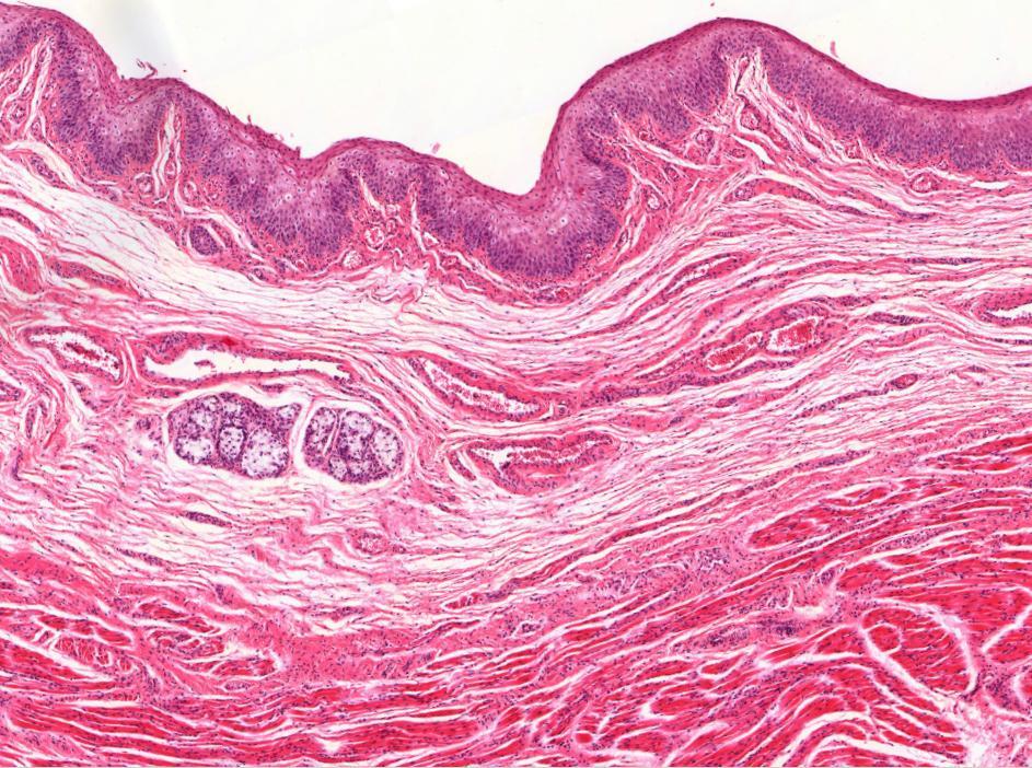 Nyel cs cs fels szakasza (1) epithelium