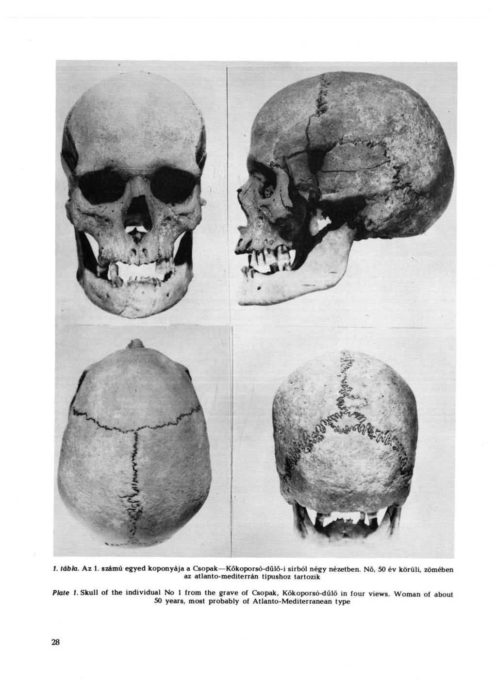 I. tábla. Az 1. számú egyed koponyája a Csopak Kőkoporsó-dűlő-i sírból négy nézetben.
