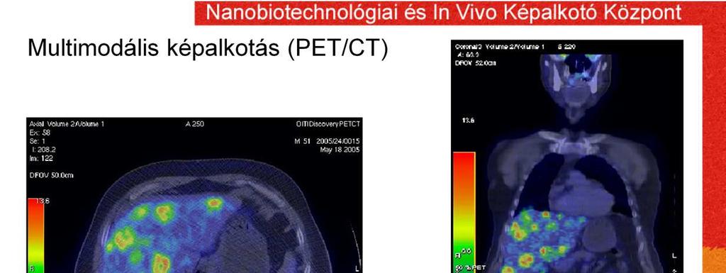 Az elmúlt évtizedben kezdtek megjelenni az olyan vizsgálati módszerek, amelyek egyesítik a morfológiai és funkcionális módszer előnyeit és az eddigieknél sokkal jobb diagnosztikai támogatást