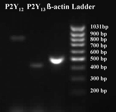 9. ábra: Patkány agytörzsön végzett szemikvantitatív RT-PCR analízis eredménye.