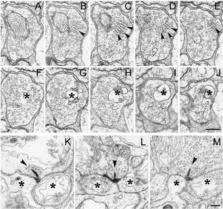 Beltag: Ellipsoid: mitokondriumok, centriolum Myoid: RER, SER Golgi készülék, mikrotubulusok stb Sejtmag: sejttestté szélesedik itt a