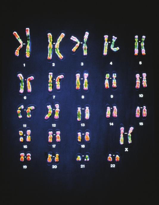 5. Osztódó emberi sejtről készült mikroszkópos felvétel. felvételen az erősen festődő transzportkromoszómák láthatók. 46 kromoszóma között hasonló alakú és méretű kromoszómák figyelhetők meg b) 6.