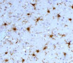 tyrosine phosphatase, receptor type, C (PTPRC), leukocyte common antigen: hematopoietikus sejteken CD163: egyik scavenger receptor (SCRC) család tagja