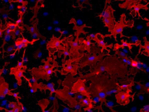 modified low-density lipoprotein (LDL), though it is currently known to bind to a variety of ligands including endogenous proteins and pathogens.