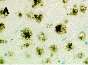 Mikroglia - markerek (csak néhány...) ED1: CD68: macrosialin; acidic, highly glycosylated lysosomal glycoproteins (LGPs) család tagja, pl.