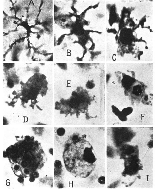 1882-1945, Spanish physician, histologist, anatomist microglia Río-Hortega rajzai. Different morphological types of microglial cells in the rabbit Ammon's horn.