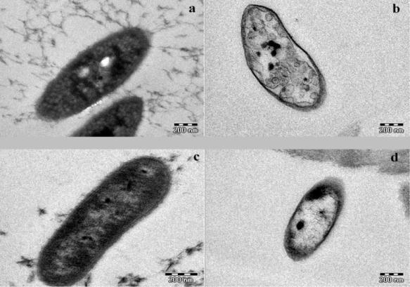 elektronmikroszkópos felvételeken. A két baktérium belső membránrendszerében vannak különbségek. Rba.