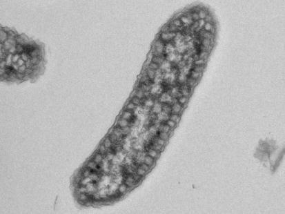 1. Bevezetés 1.1 Fotoszintetikus prokarióták A baktériumok népes családjából csak viszonylag kevés képes fotoszintetizálni.