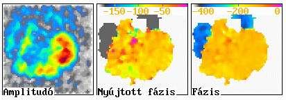 VENTRICULO SZCINTIGRÁFIA EREDMÉNYLAP PÉCSI TUDOMÁNYEGYETEM ÁLTALÁNOS