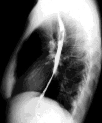 Vizsgáló módszerek echocardiographia (méret, falvastagság, mozgás, áramlás) röntgen (a szív alakjának/méreteinek becslése + a tüdőkeringés megítélése) invazív diagnosztika és intervenció
