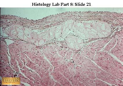 Endocardium Purkinje rost Miocardium