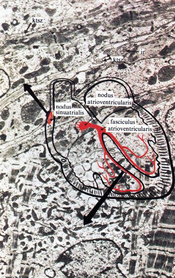 myofibrillumot. Sejtmagok körül glikogén. A szív ingertermelő (sinuscsomó) és ingervezető (His-köteg) rendszere sémásan és fontosabb részeinek elektronmikroszkópos szerkezete; (Virágh Sz. felvételei).