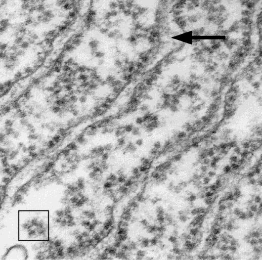 Neuronális fehérjeszintézis, sorting Nissl testek: perikarionban és proximális dendritekben RER