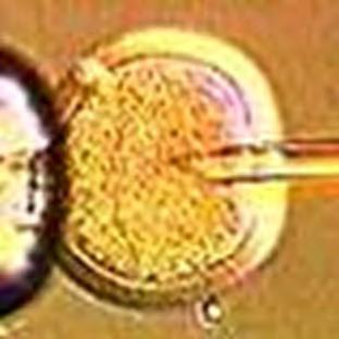 REPRODUKTÍV SIKERTELENSÉG FOGALMAK Infertilitás (primer, szekunder) In vitro fertilizáció eredménytelensége Terhesség (ismételt 3) megszakadása Spontán vetélés Missed Ab/elhalt terhesség Koraszülés