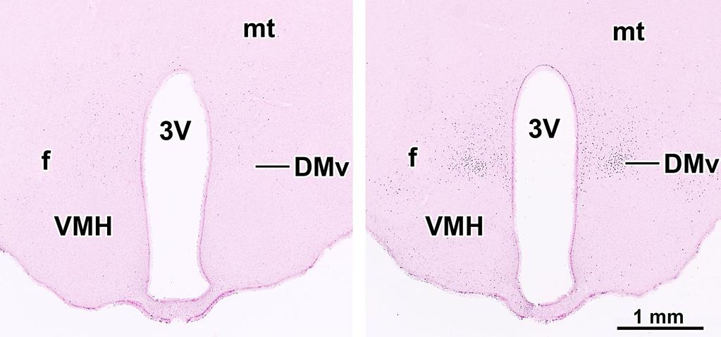 FOS INDUKCIÓ A HYPOTHALAMUS DORSOMEDIÁLIS