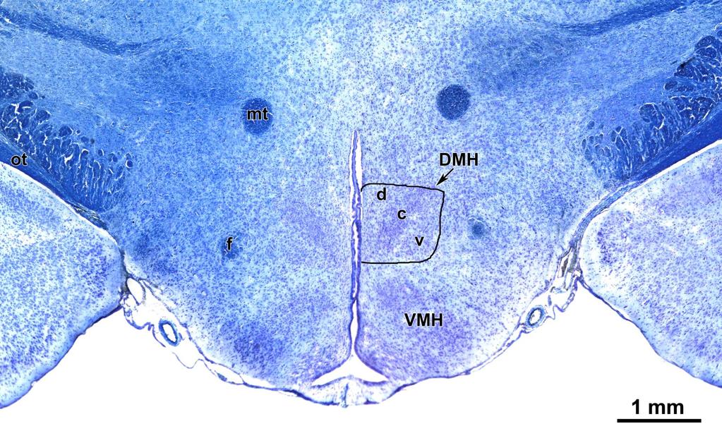 A HYPOTHALAMUS DORSOMEDIÁLIS MAGJÁNAK (DMH)