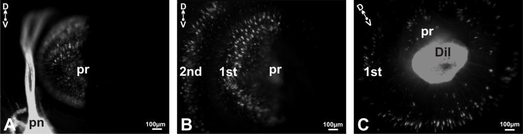 11. ábra. Jelölt szenzoros sejtek a Lumbricus terrestris anterior szelvényeiben. A. DiI-al jelölt primer érzékhámsejtek a prosztómium epithéljében a jobb oldali prosztómiális ideg töltését követően.
