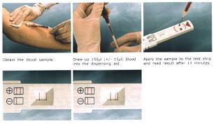 A GYORSTESZT KIVITELEZÉSE Vérvétel Heparinos csőbe vagy fecskendôbe Szívjunk fel 150 µl (± 15 µl) Mérjük rá a mintát a teszt csík vért pipettába v.