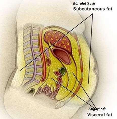 intraabdominálisan halmozódik fel