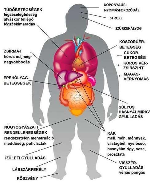 14. A beteg hiperglikémiás, de a glükóz nem jut a sejtbe, a zsírsejtből nem tud energia jönni, mert az inzulin nem engedi a zsírsavoxidációt. 15.