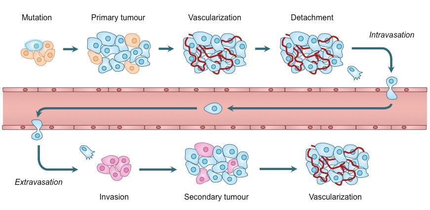 Metasztatikus kaszkád Tumorsejtek elválása egymástól ECM és BM