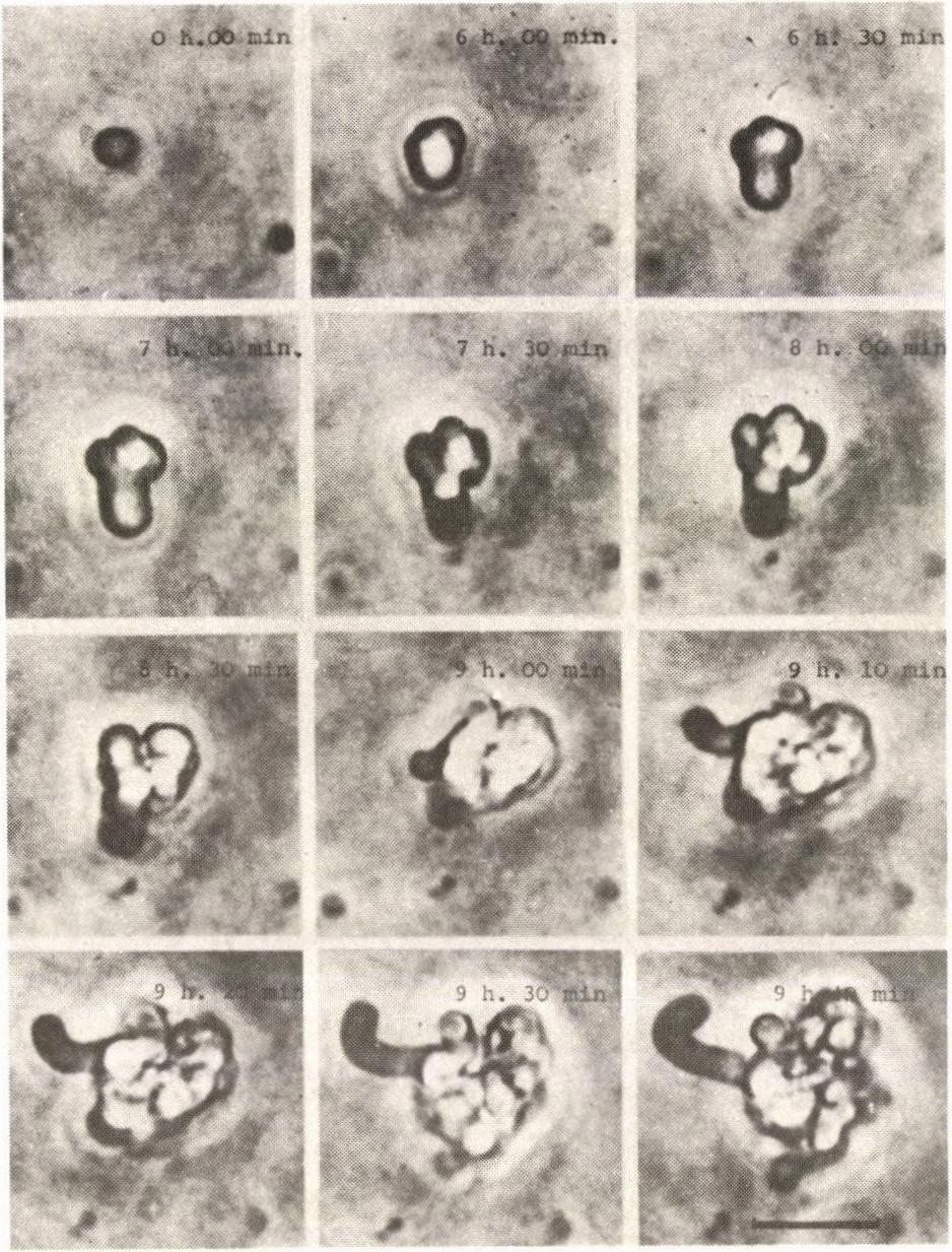 3. kép. Egy Bacillus megaterium protoplaszt baktériumformává történő visszaalakulásának időbeli lépései. Fáziskontraszt-mikroszkópos felvétel.