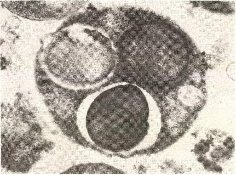 6. kép. Bacillus sublilis PEG-kezelés hatására fuzionált protoplasztjainak metszete egyszerre több prespórát tartalmaz (Prof. P. Schaeffer anyagából). készült felvétel látható.